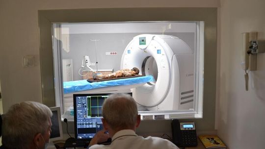 Lubelscy radiolodzy zajrzeli do wnętrza egipskiej mumii. Przełomowe badania sprzed 2 tys. lat