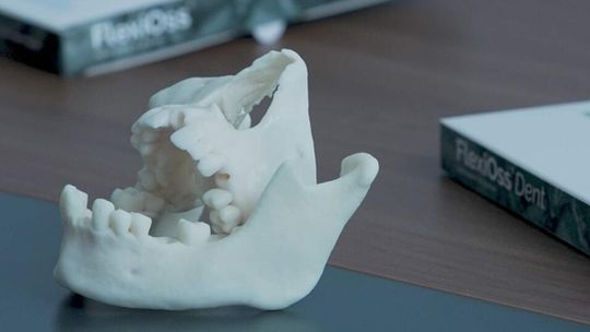 Lubelska „sztuczna kość” przyspiesza ekspansję. Trwa automatyzacja produkcji i wejście na nowe rynki