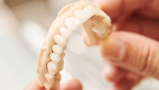 Protetyka stomatologiczna – co to jest?