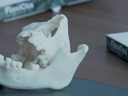 Lubelska „sztuczna kość” przyspiesza ekspansję. Trwa automatyzacja produkcji i wejście na nowe rynki