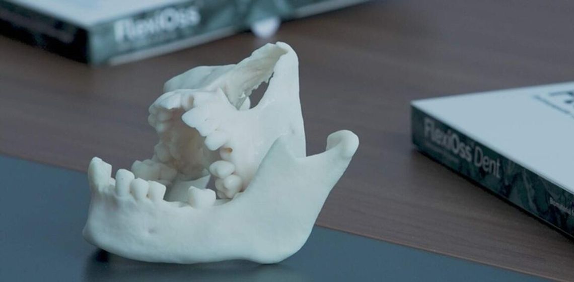 Lubelska „sztuczna kość” przyspiesza ekspansję. Trwa automatyzacja produkcji i wejście na nowe rynki Lubelska „sztuczna kość” przyspiesza ekspansję. Trwa automatyzacja produkcji i wejście na nowe rynki